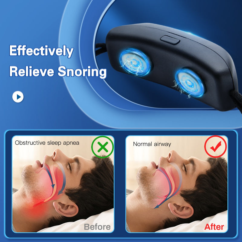 Dispositivo Inteligente Anti-Ronco e Apneia SleepRex™ Geração II